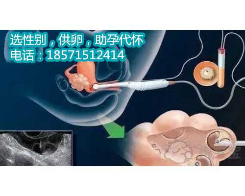<b>北京供卵流程,一个受孕的奇迹</b>